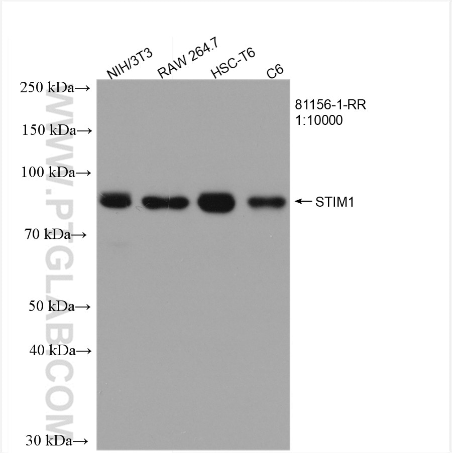 Western Blot (WB) analysis of various lysates using STIM1 Recombinant antibody (81156-1-RR)