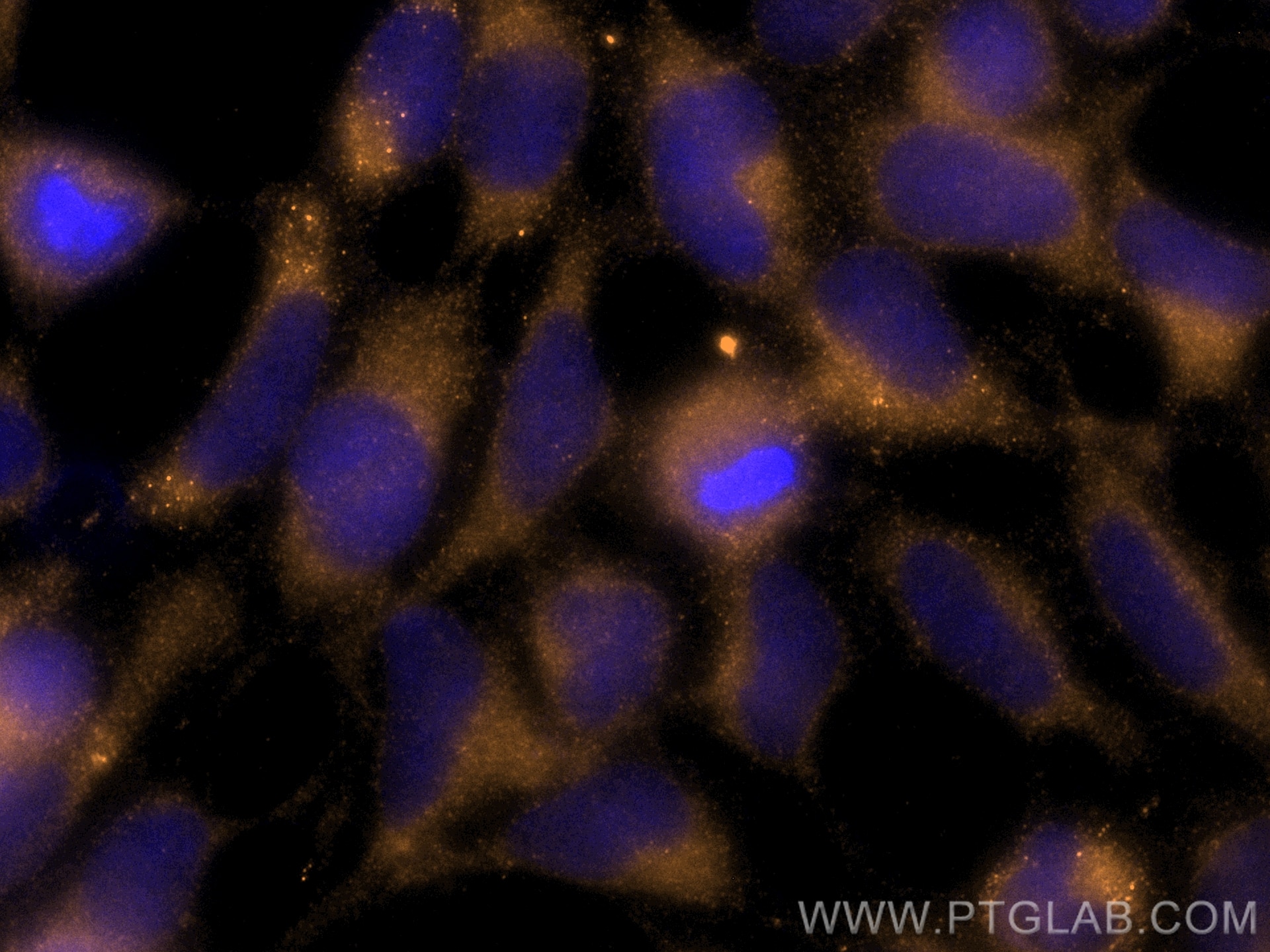 Immunofluorescence (IF) / fluorescent staining of HEK-293 cells using CoraLite® Plus 555-conjugated STIM1 Polyclonal ant (CL555-11565)
