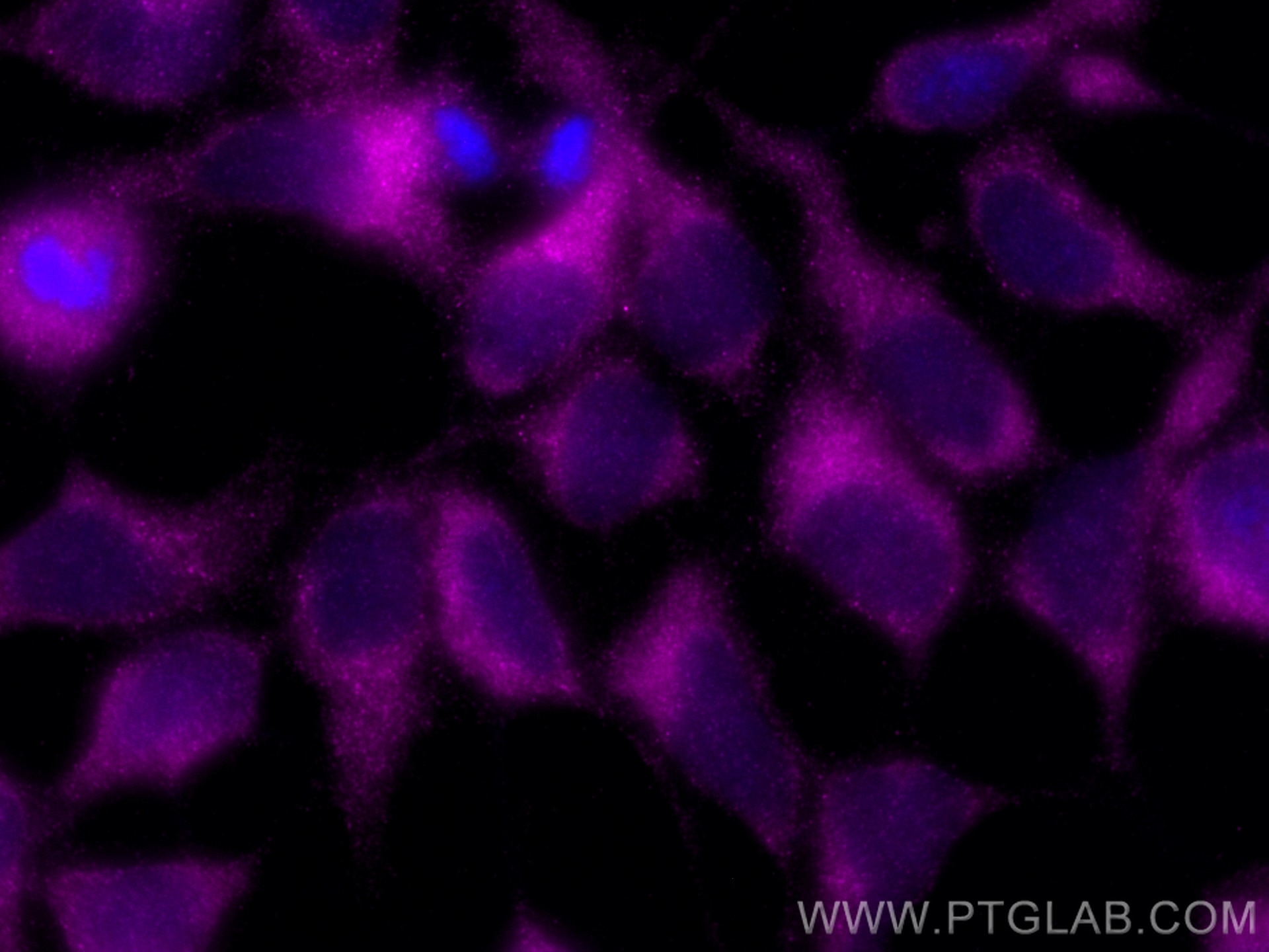 Immunofluorescence (IF) / fluorescent staining of HEK-293 cells using CoraLite® Plus 647-conjugated STIM1 Polyclonal ant (CL647-11565)