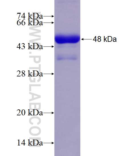 STIM1 fusion protein Ag17914 SDS-PAGE