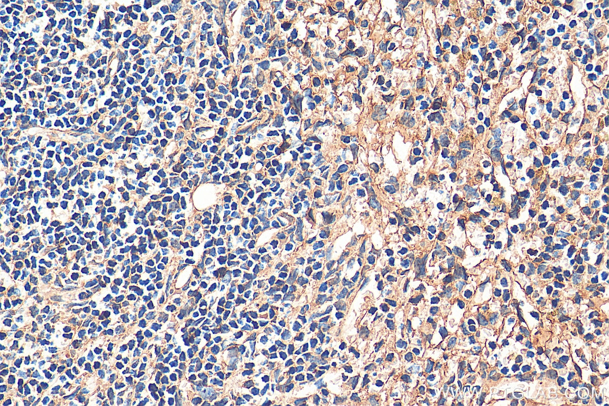 Immunohistochemistry (IHC) staining of mouse spleen tissue using STIM2 Polyclonal antibody (21192-1-AP)