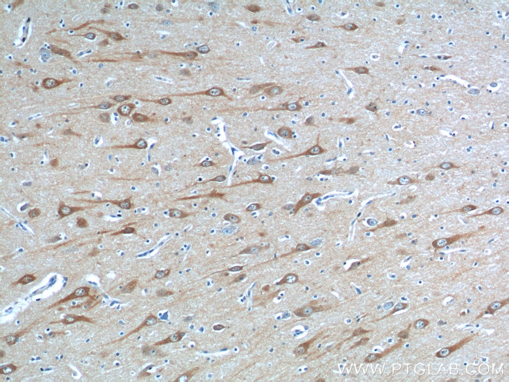 Immunohistochemistry (IHC) staining of human brain tissue using STIM2 Polyclonal antibody (21192-1-AP)