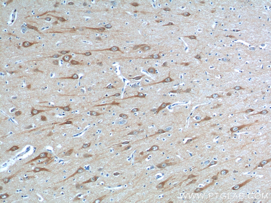 Immunohistochemistry (IHC) staining of human brain tissue using STIM2 Polyclonal antibody (21192-1-AP)