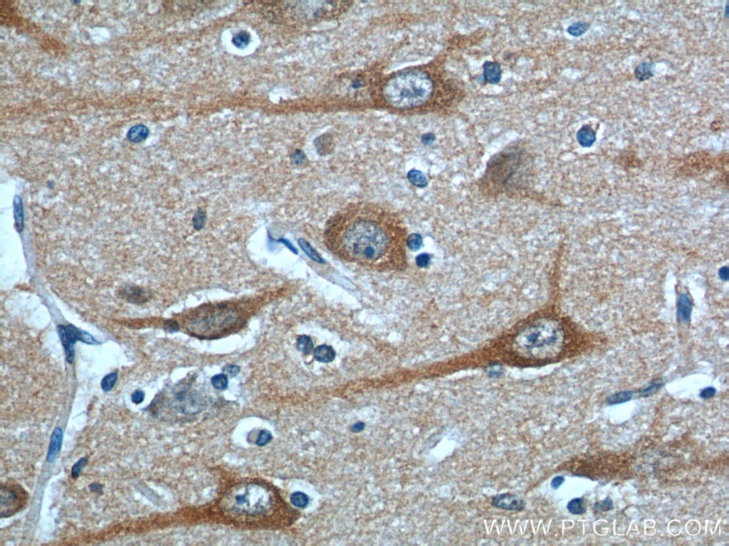 Immunohistochemistry (IHC) staining of human brain tissue using STIM2 Polyclonal antibody (21192-1-AP)