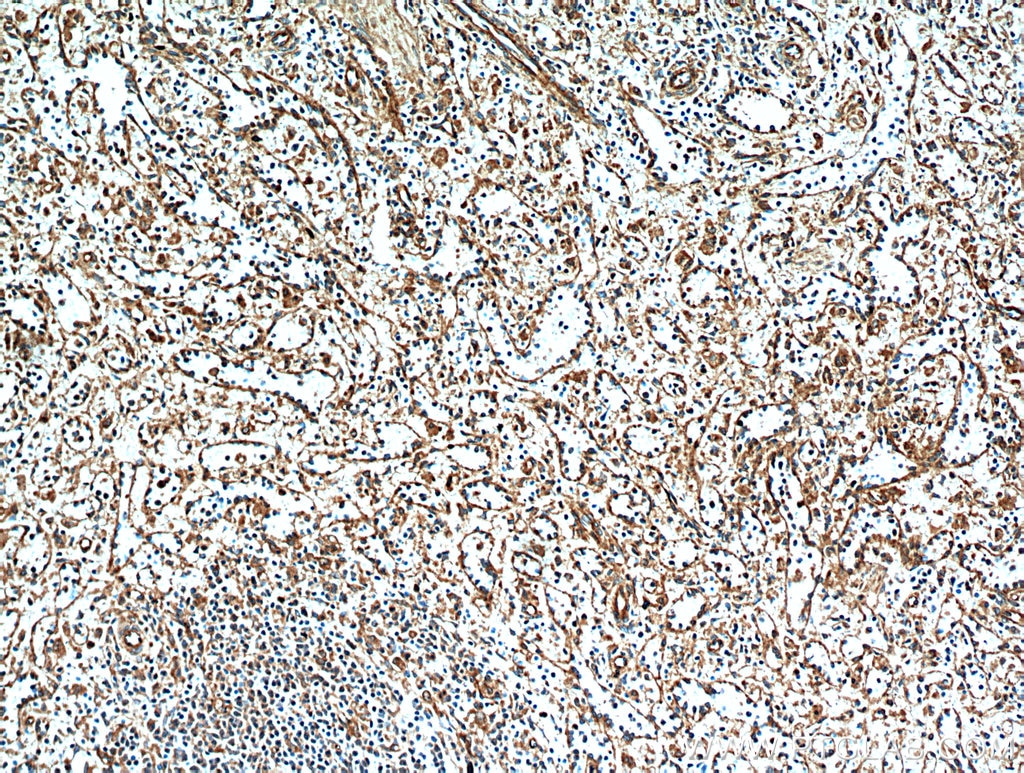 Immunohistochemistry (IHC) staining of human spleen tissue using STIM2 Polyclonal antibody (21192-1-AP)