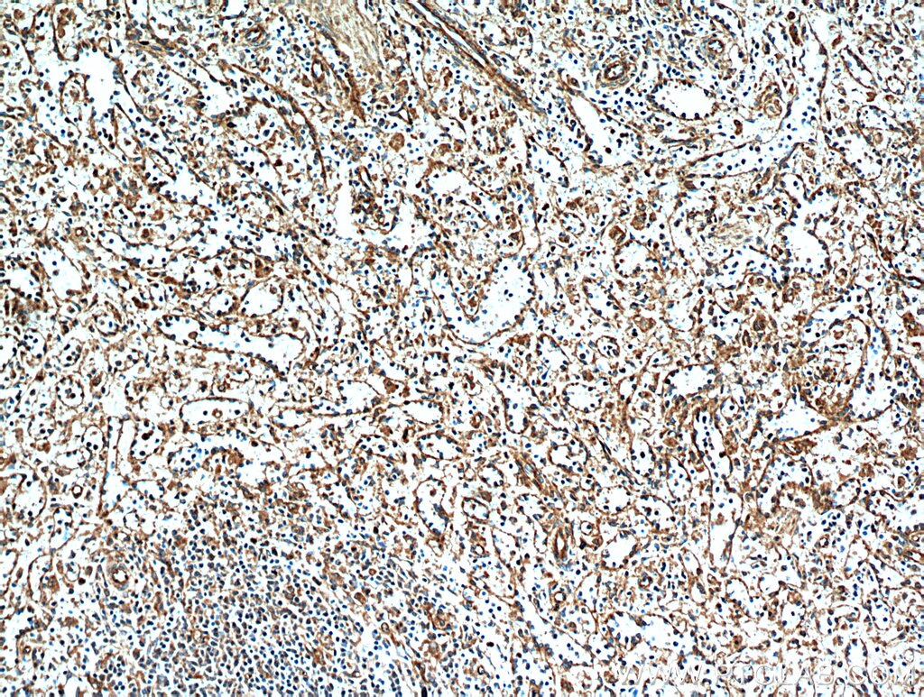 IHC staining of human spleen using 21192-1-AP