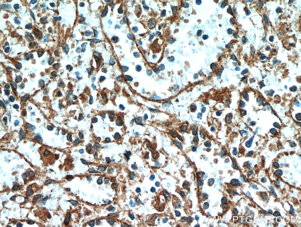 Immunohistochemistry (IHC) staining of human spleen tissue using STIM2 Polyclonal antibody (21192-1-AP)