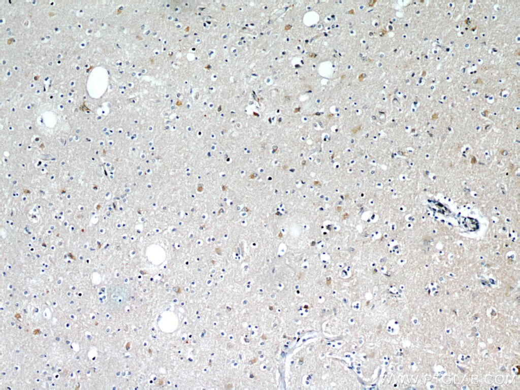 Immunohistochemistry (IHC) staining of human brain tissue using STIM2 Polyclonal antibody (21192-1-AP)