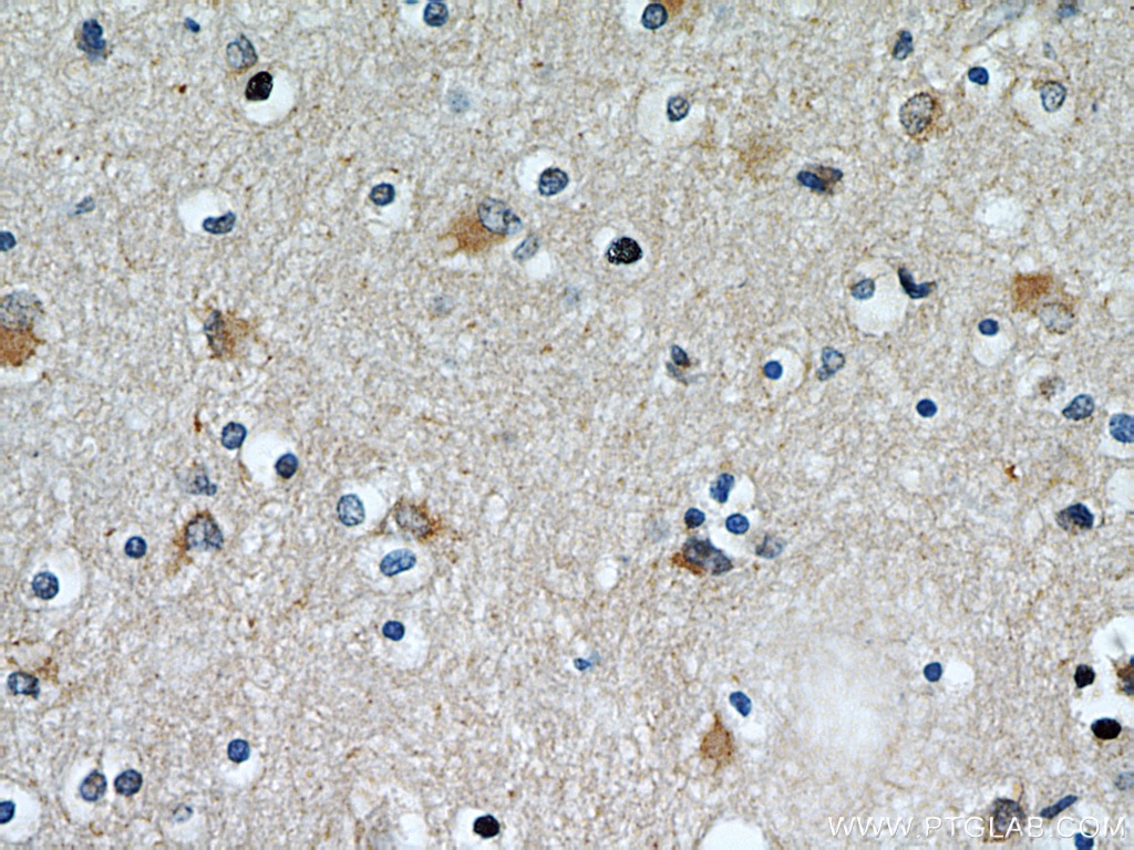 Immunohistochemistry (IHC) staining of human brain tissue using STIM2 Polyclonal antibody (21192-1-AP)