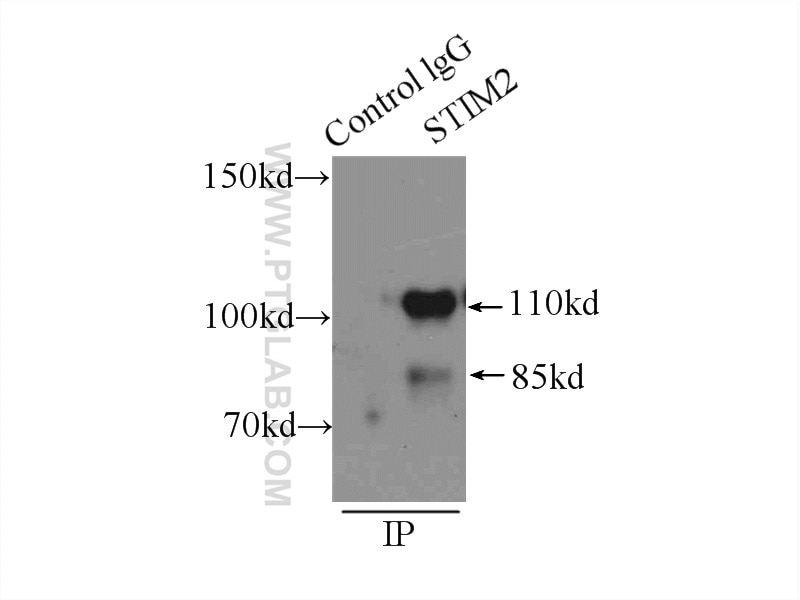 Immunoprecipitation (IP) experiment of HEK-293 cells using STIM2 Polyclonal antibody (21192-1-AP)