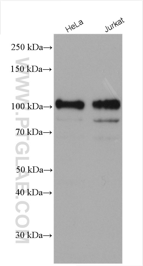 Western Blot (WB) analysis of various lysates using STIM2 Polyclonal antibody (21192-1-AP)