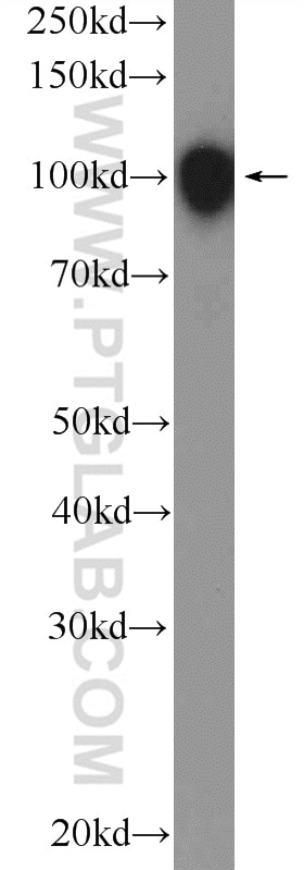 Western Blot (WB) analysis of HEK-293 cells using STIM2 Polyclonal antibody (21192-1-AP)