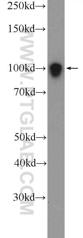 Western Blot (WB) analysis of Jurkat cells using STIM2 Polyclonal antibody (21192-1-AP)