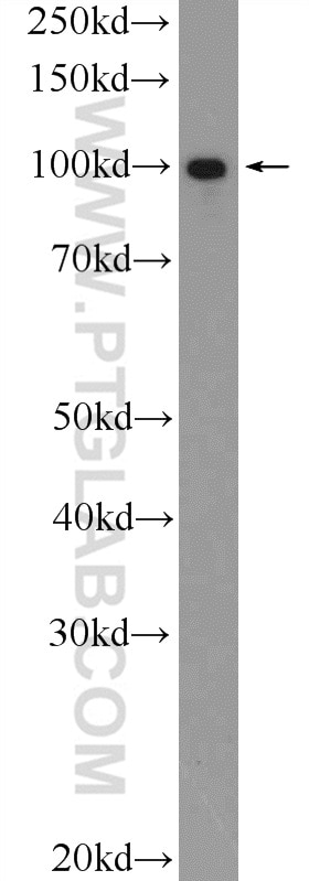 STIM2 Polyclonal antibody