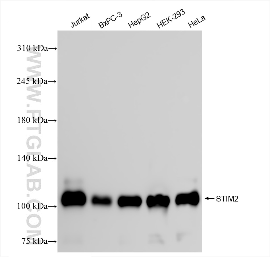 Western Blot (WB) analysis of various lysates using STIM2 Recombinant antibody (85727-1-RR)