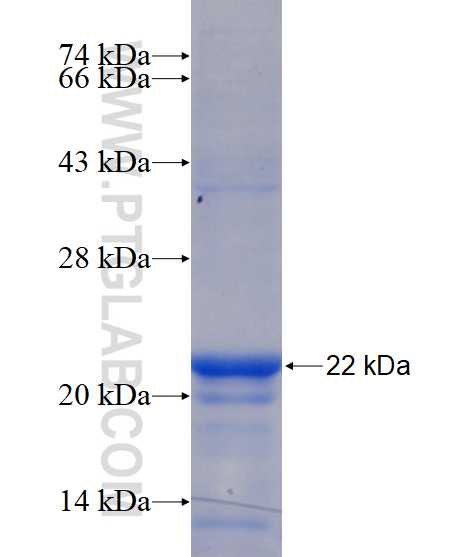 STIM2 fusion protein Ag15949 SDS-PAGE