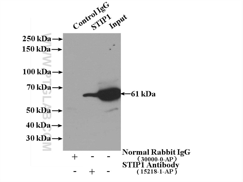 Immunoprecipitation (IP) experiment of Jurkat cells using STIP1 Polyclonal antibody (15218-1-AP)