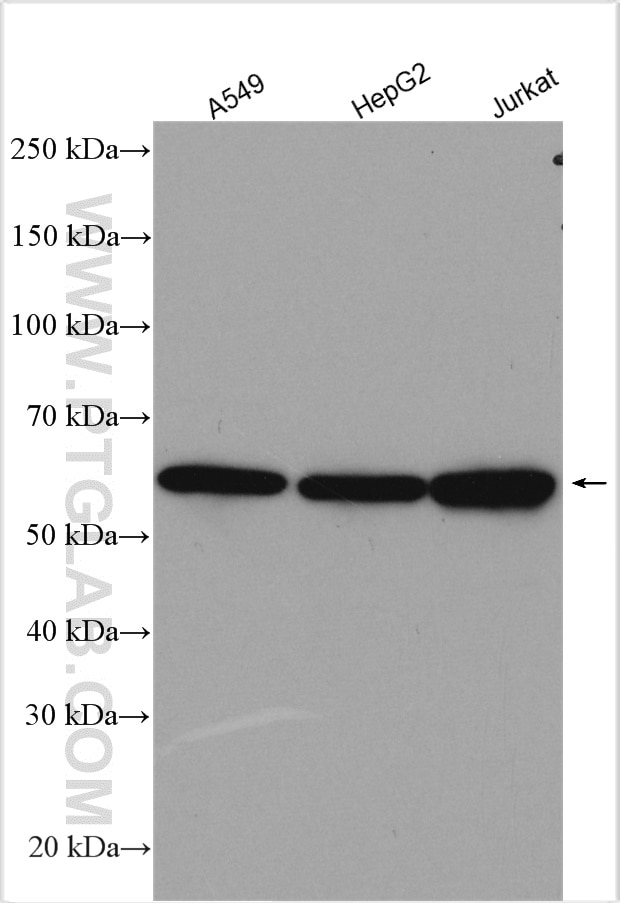 Western Blot (WB) analysis of various lysates using STIP1 Polyclonal antibody (15218-1-AP)