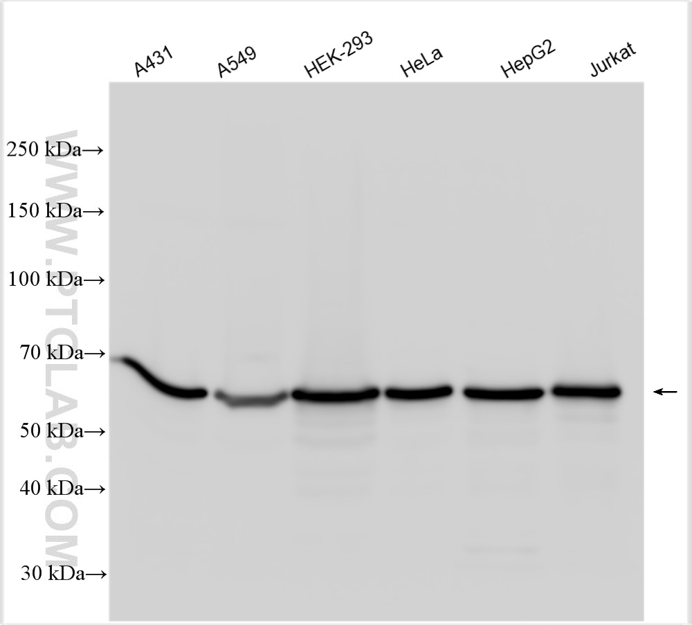 Western Blot (WB) analysis of various lysates using STIP1 Polyclonal antibody (15218-1-AP)