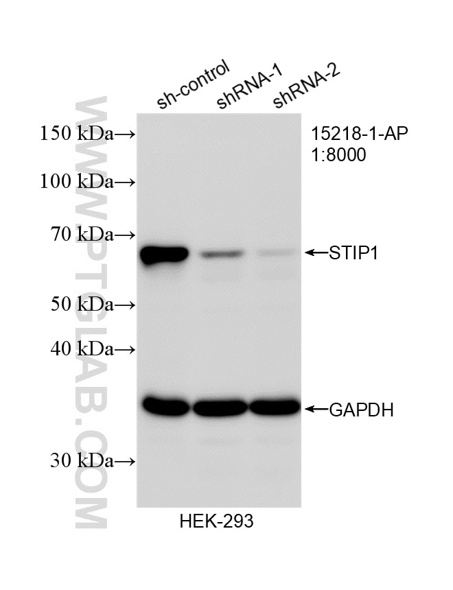 Western Blot (WB) analysis of HEK-293 cells using STIP1 Polyclonal antibody (15218-1-AP)