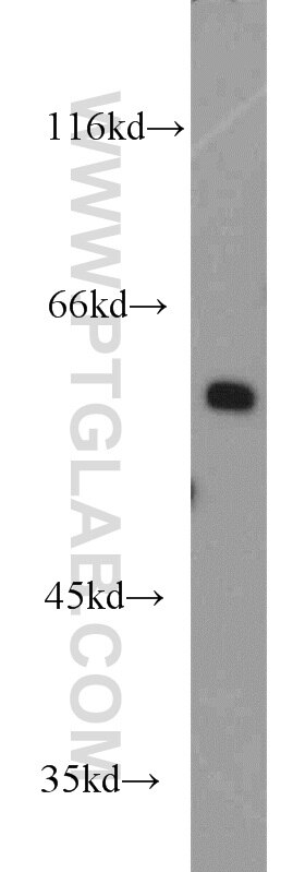 STIP1 Polyclonal antibody