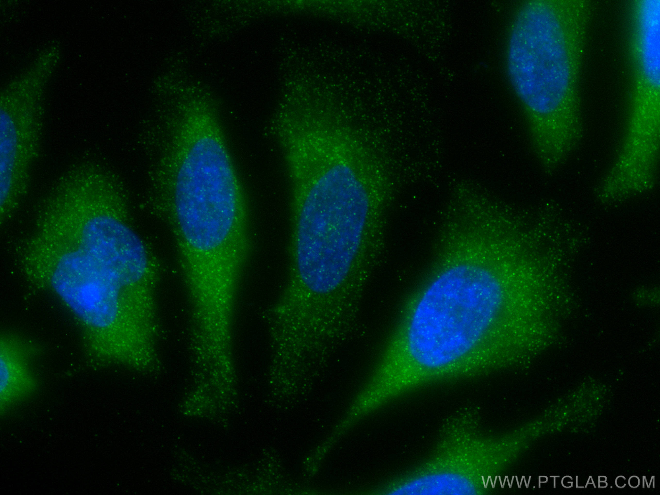 Immunofluorescence (IF) / fluorescent staining of HeLa cells using STIP1 Monoclonal antibody (68155-1-Ig)