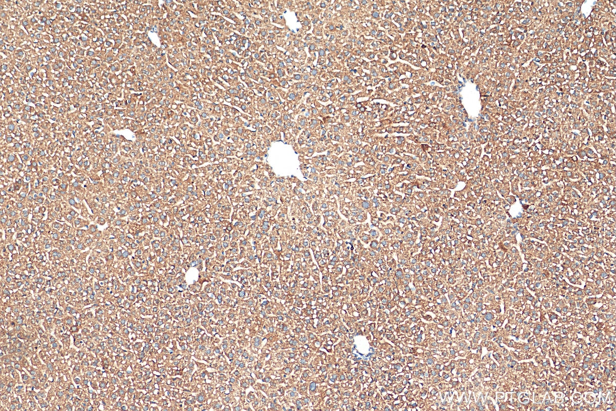 IHC staining of mouse liver using 68155-1-Ig