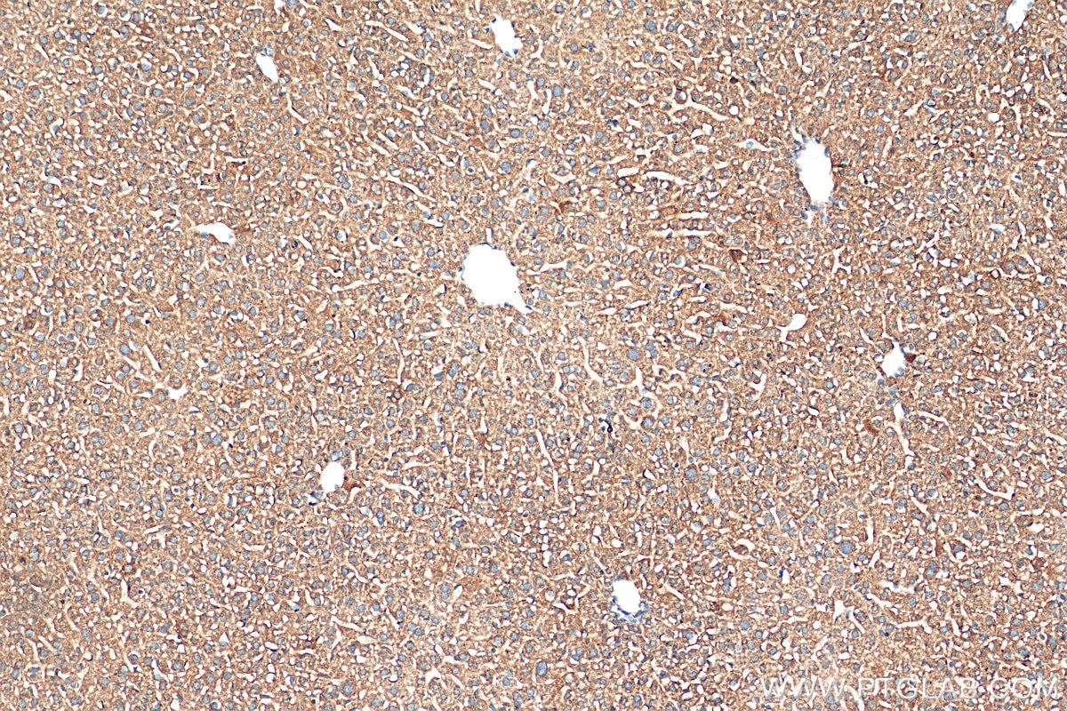 Immunohistochemistry (IHC) staining of mouse liver tissue using STIP1 Monoclonal antibody (68155-1-Ig)