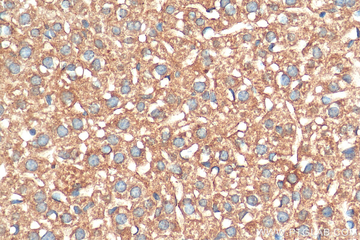 Immunohistochemistry (IHC) staining of mouse liver tissue using STIP1 Monoclonal antibody (68155-1-Ig)