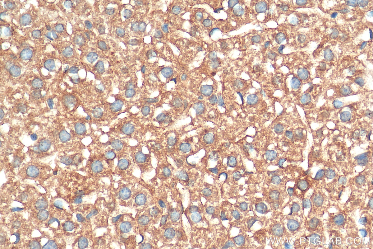 Immunohistochemistry (IHC) staining of mouse liver tissue using STIP1 Monoclonal antibody (68155-1-Ig)