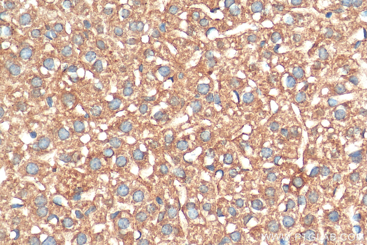 Immunohistochemistry (IHC) staining of mouse liver tissue using STIP1 Monoclonal antibody (68155-1-Ig)