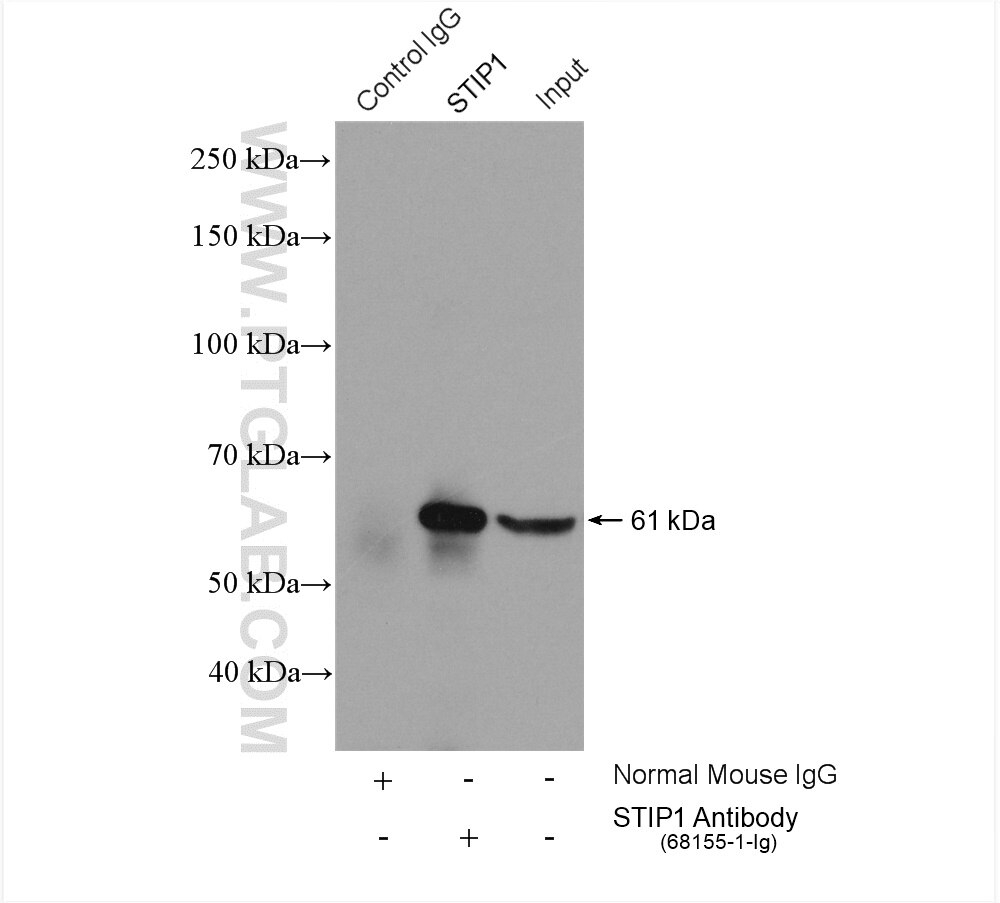 Immunoprecipitation (IP) experiment of Jurkat cells using STIP1 Monoclonal antibody (68155-1-Ig)