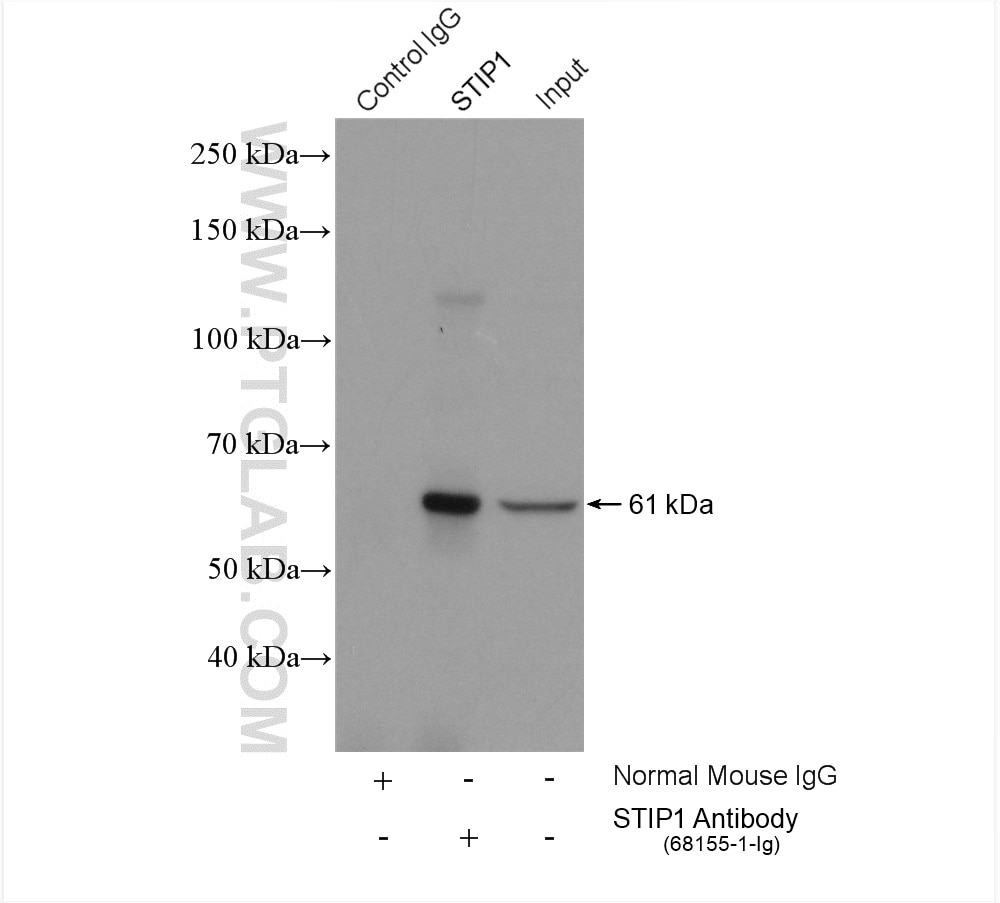 Immunoprecipitation (IP) experiment of HeLa cells using STIP1 Monoclonal antibody (68155-1-Ig)