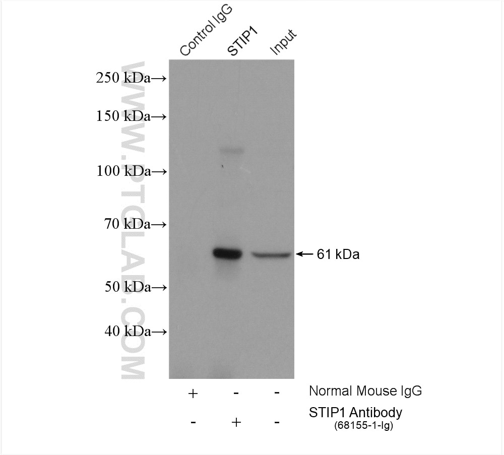 IP experiment of HeLa using 68155-1-Ig