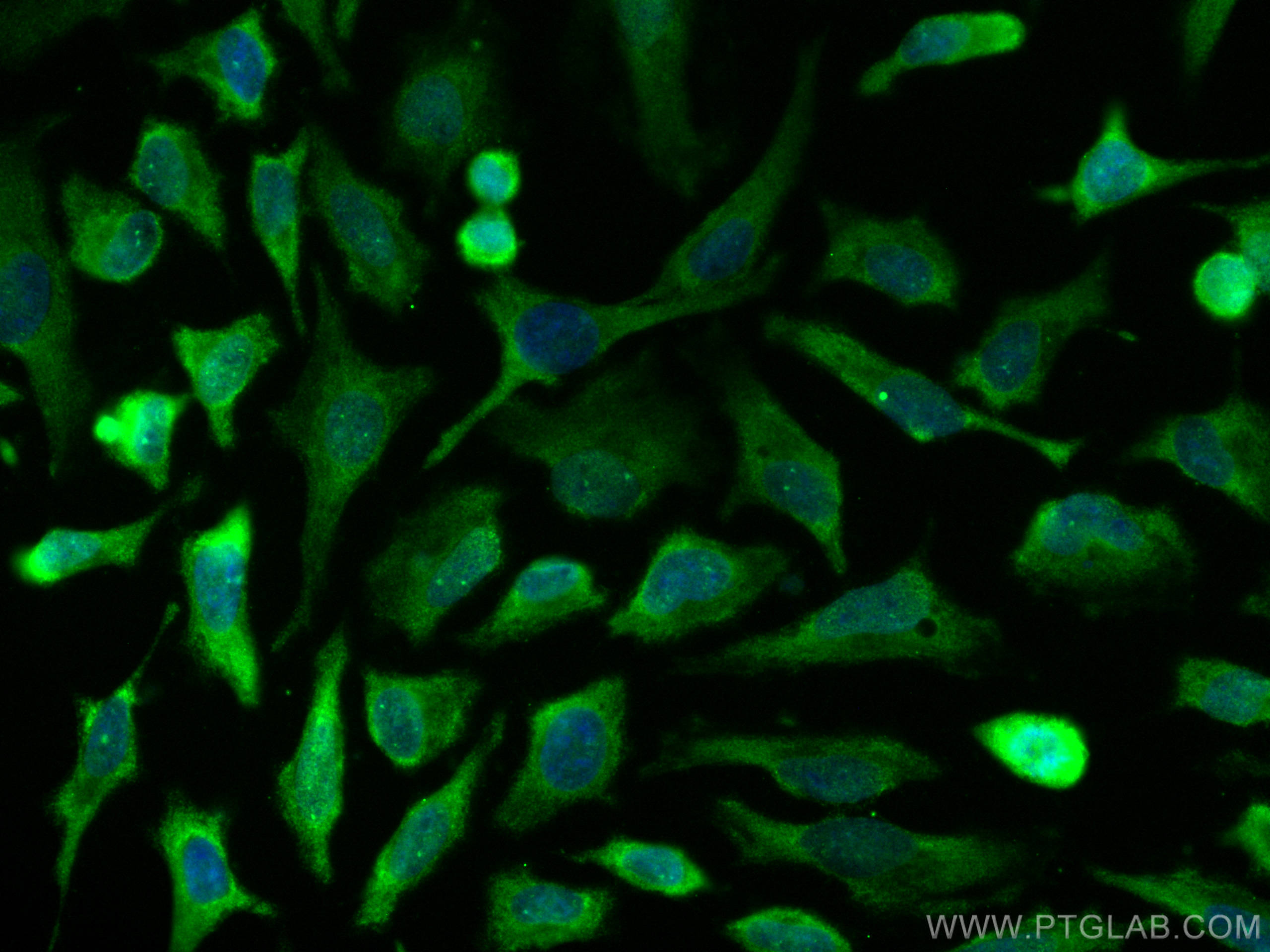 IF Staining of HeLa using CL488-68155