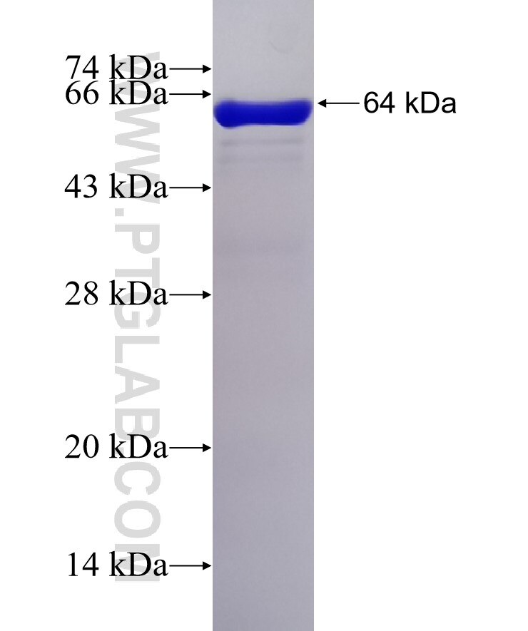 STIP1 fusion protein Ag7388 SDS-PAGE