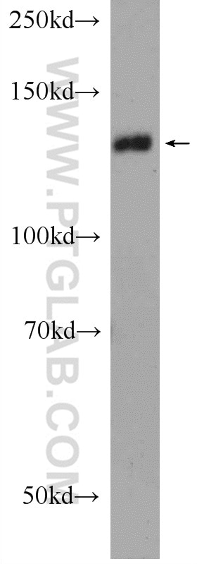 Western Blot (WB) analysis of A549 cells using STK10 Polyclonal antibody (25471-1-AP)