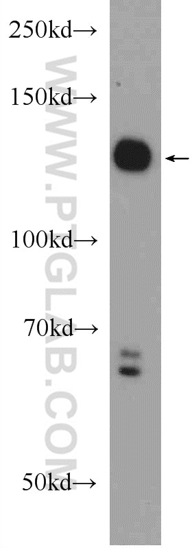 Western Blot (WB) analysis of COLO 320 cells using STK10 Polyclonal antibody (25471-1-AP)