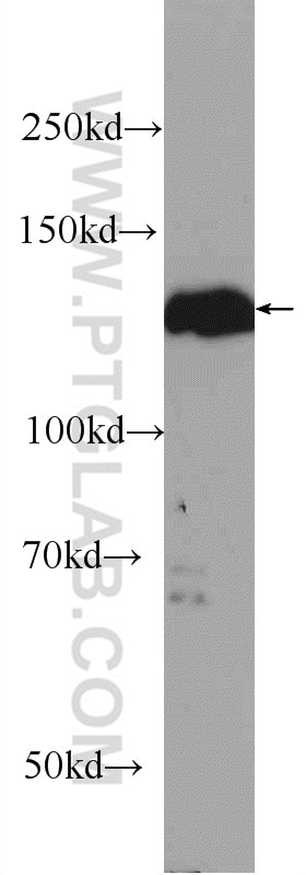 Western Blot (WB) analysis of SKOV-3 cells using STK10 Polyclonal antibody (25471-1-AP)
