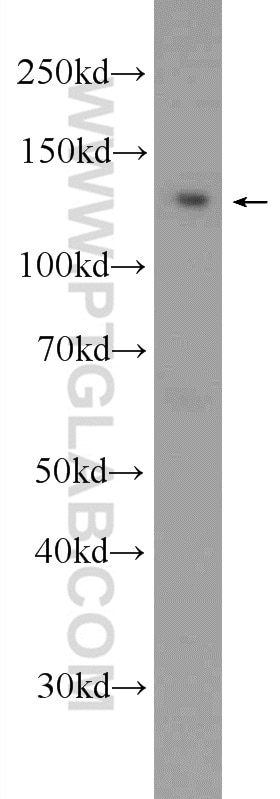 WB analysis of A549 using 25471-1-AP