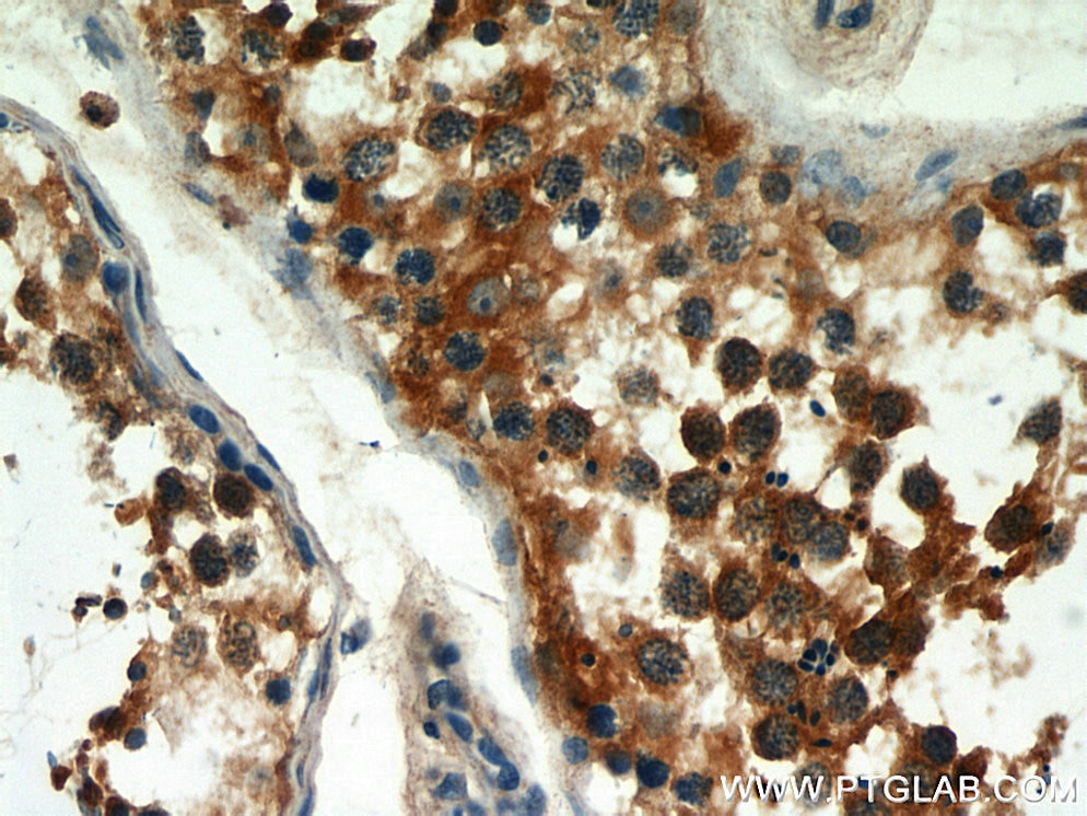 Immunohistochemistry (IHC) staining of human testis tissue using STK11/LKB1 Polyclonal antibody (10746-1-AP)