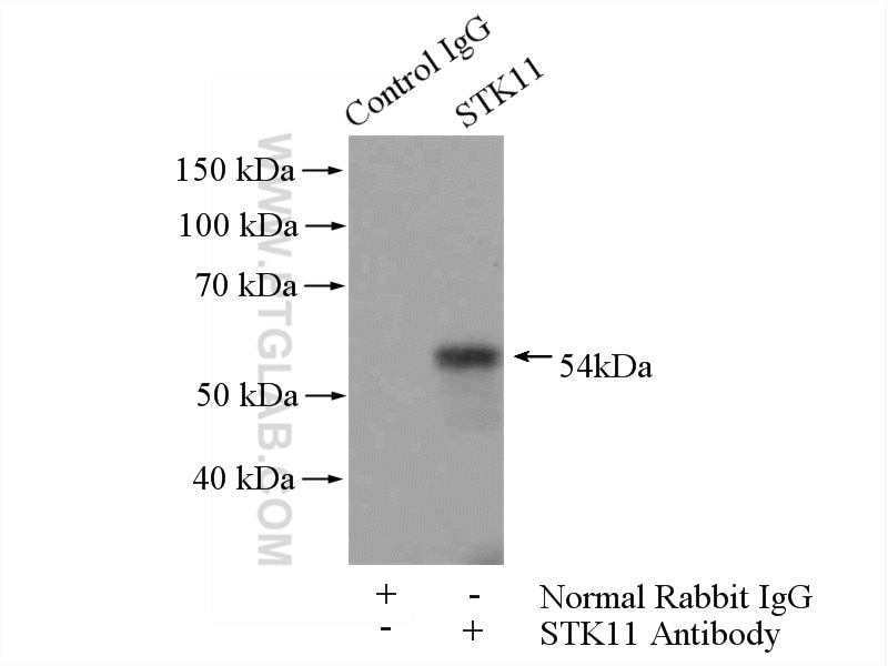 Immunoprecipitation (IP) experiment of HEK-293 cells using STK11/LKB1 Polyclonal antibody (10746-1-AP)