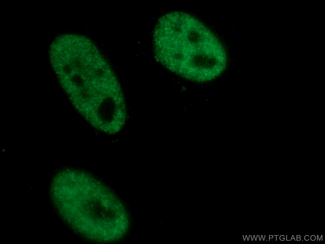 Immunofluorescence (IF) / fluorescent staining of HeLa cells using STK11/LKB1 Monoclonal antibody (66719-1-Ig)