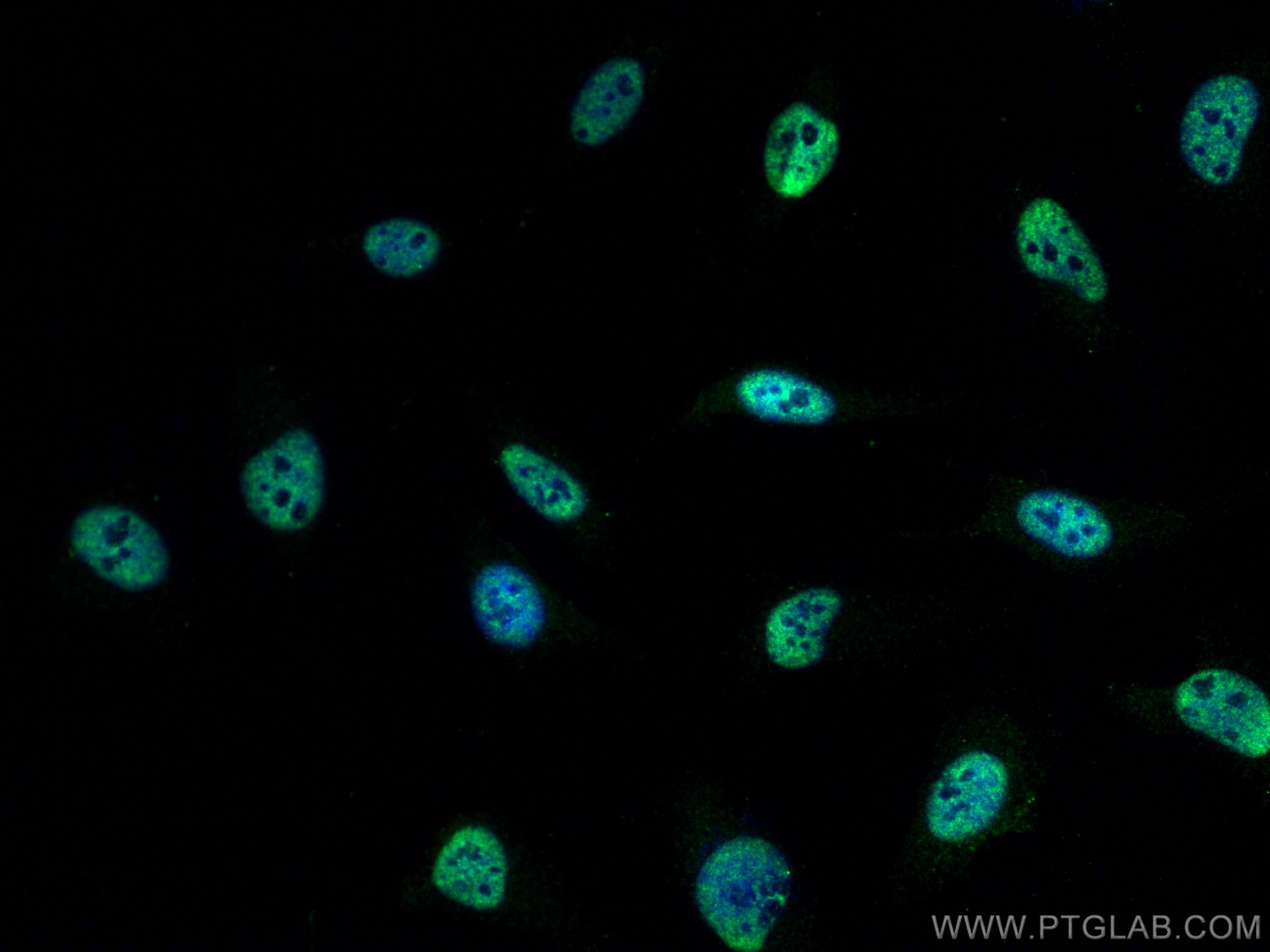 Immunofluorescence (IF) / fluorescent staining of HeLa cells using STK11/LKB1 Monoclonal antibody (66719-1-Ig)