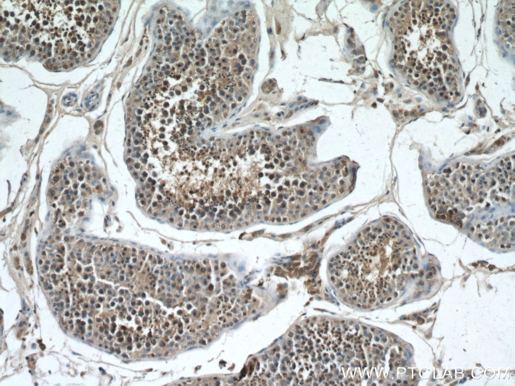 Immunohistochemistry (IHC) staining of human testis tissue using STK11/LKB1 Monoclonal antibody (66719-1-Ig)