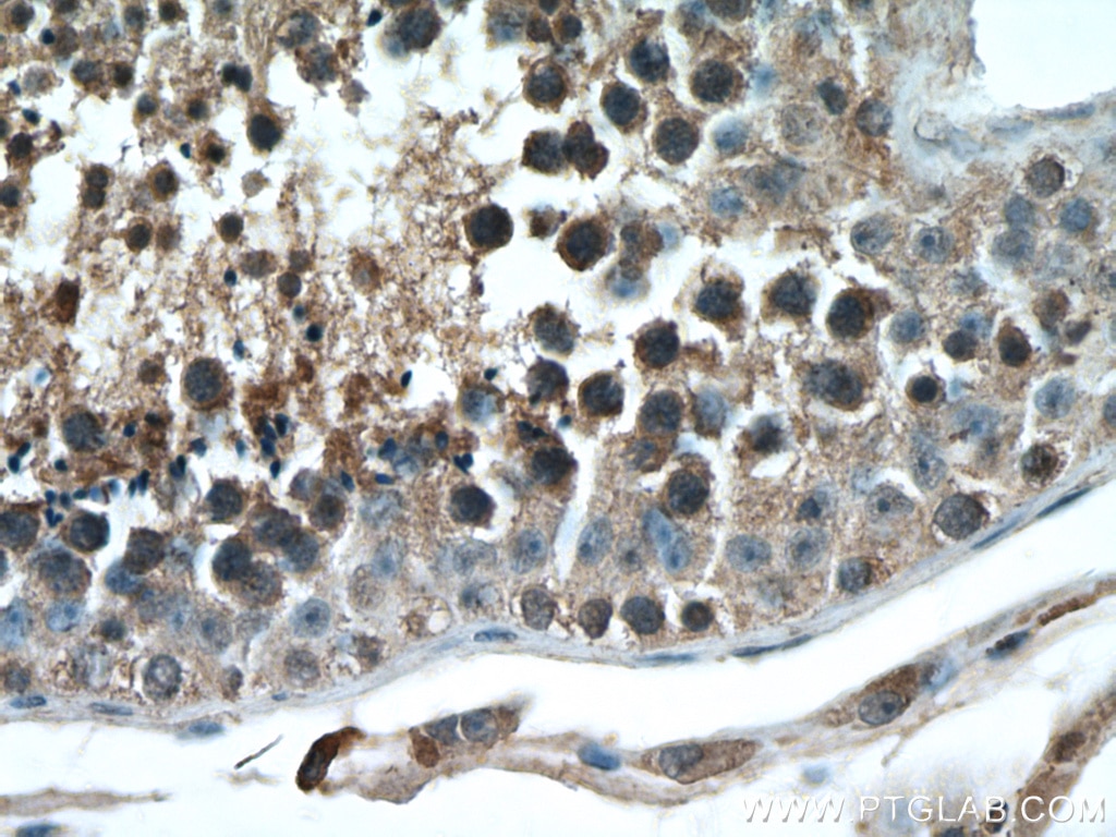 Immunohistochemistry (IHC) staining of human testis tissue using STK11/LKB1 Monoclonal antibody (66719-1-Ig)