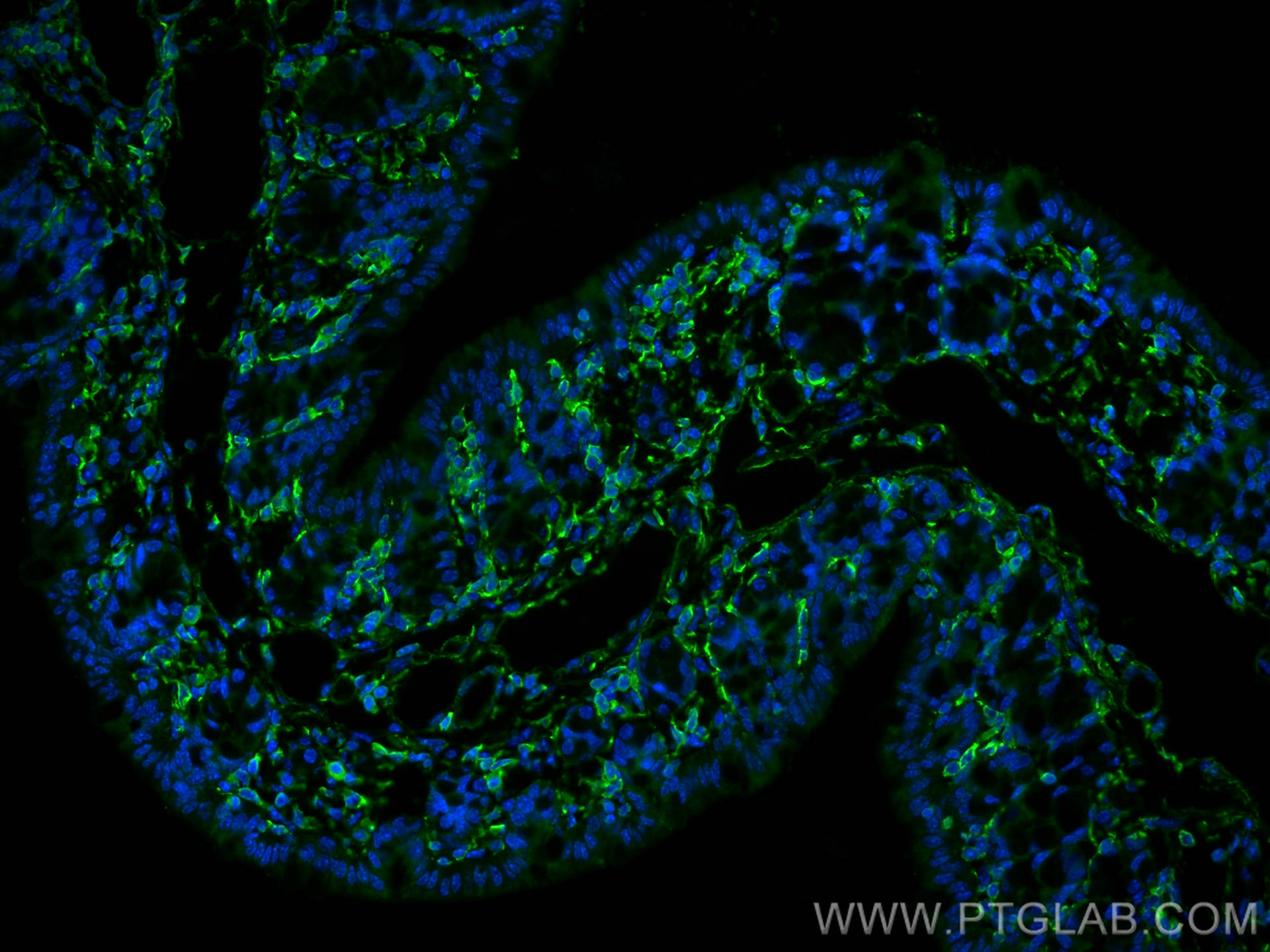 Immunofluorescence (IF) / fluorescent staining of mouse colon tissue using STK11/LKB1 Monoclonal antibody (68016-1-Ig)