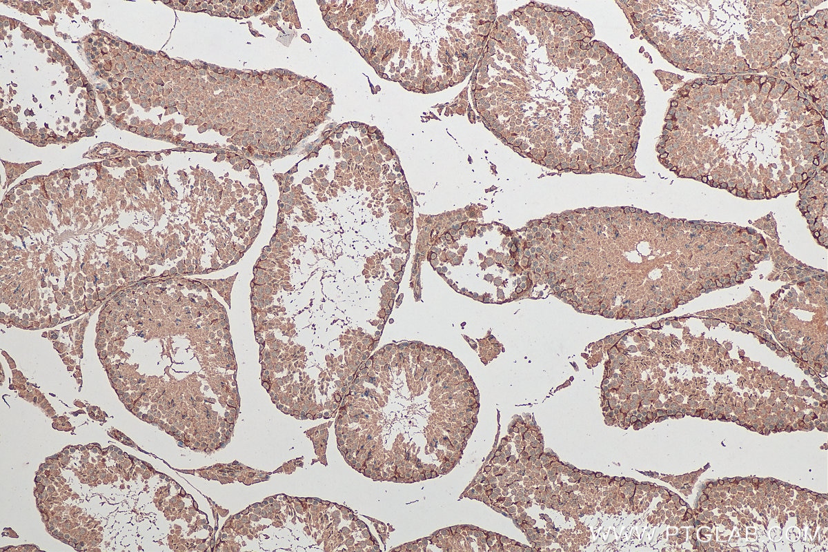 Immunohistochemistry (IHC) staining of mouse testis tissue using STK11/LKB1 Monoclonal antibody (68016-1-Ig)