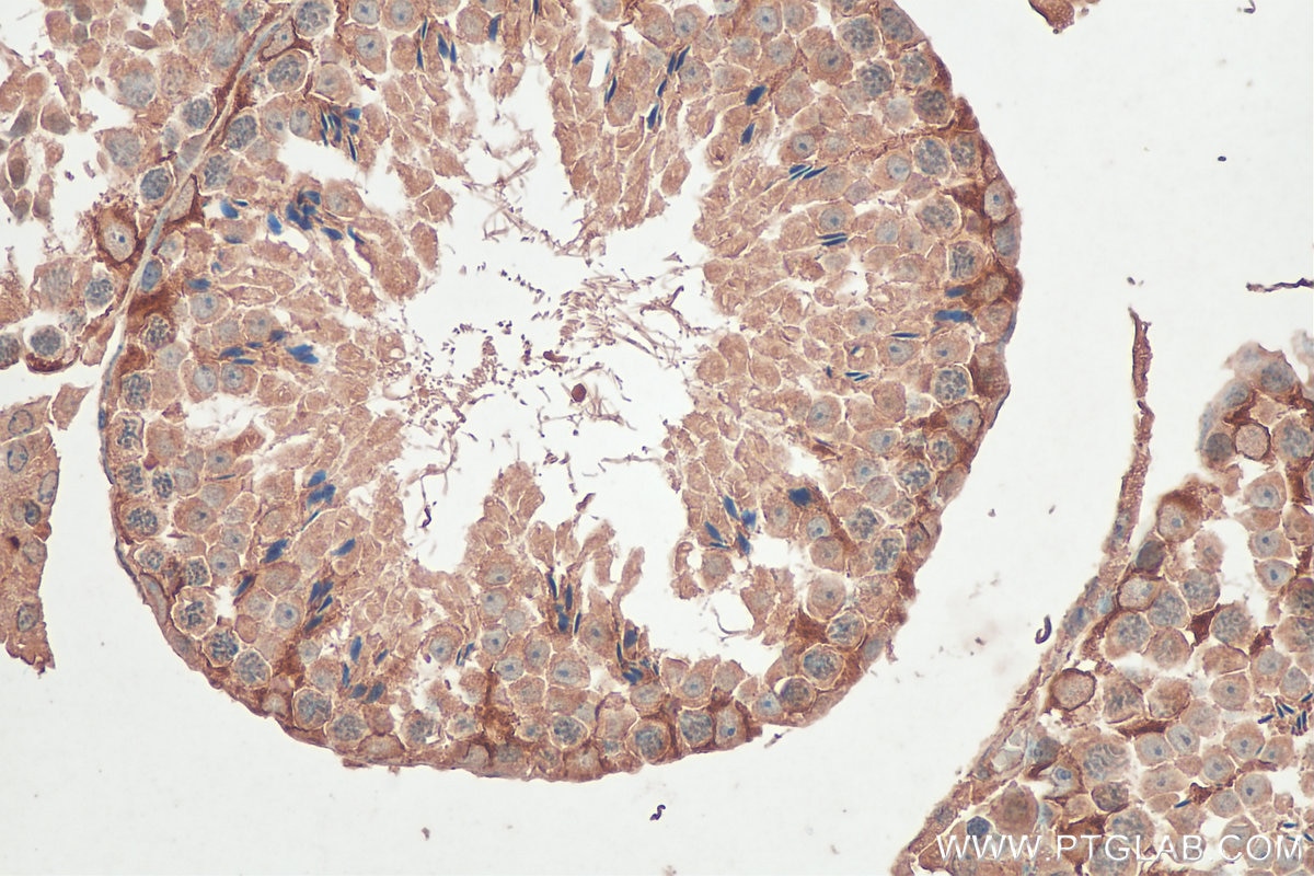 IHC staining of mouse testis using 68016-1-Ig