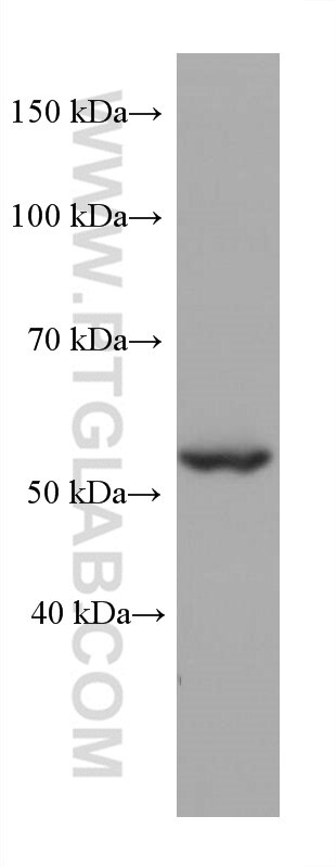 Western Blot (WB) analysis of PC-3 cells using STK11/LKB1 Monoclonal antibody (68016-1-Ig)